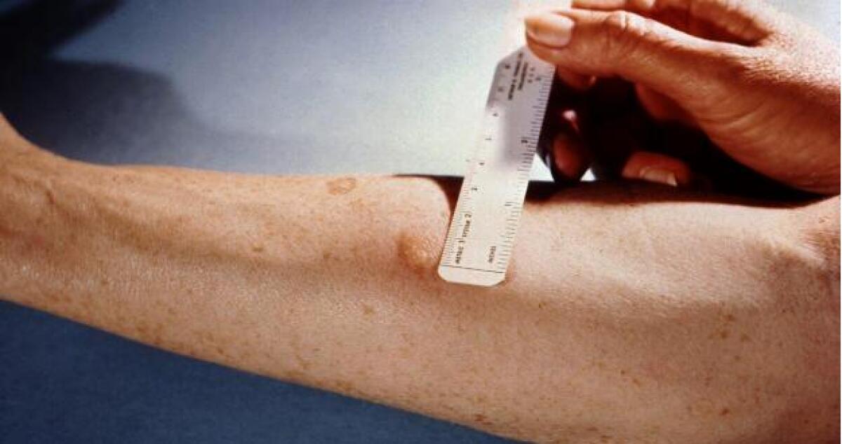 Alimentazione e tumore, un convegno per spiegare il ruolo del cibo - 