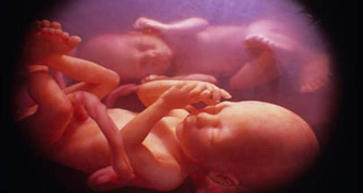 Raro caso di malformazione in ospedale, neonato dato alla luce "senza sesso" - 