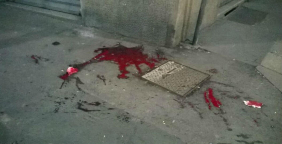 Esplode la violenza in via Tasso, colpito un bambino durante una rissa: trasferito al Sant'Elia - 