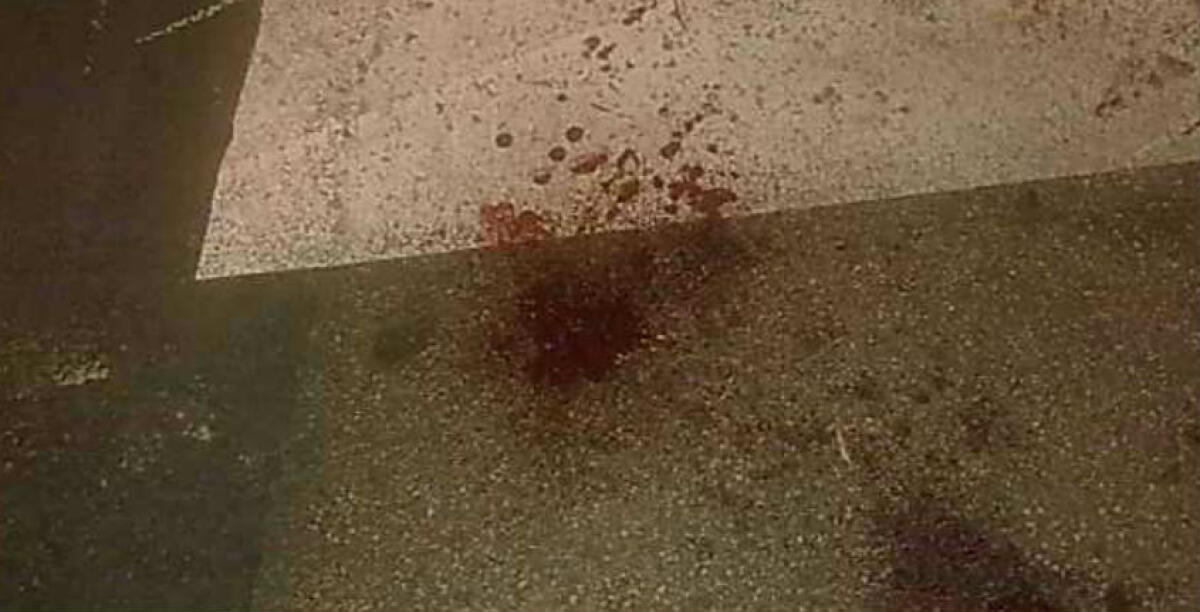 Accoltellato da un suo conoscente a Settefarine, diverse ferite per un giovane finito in ospedale - 