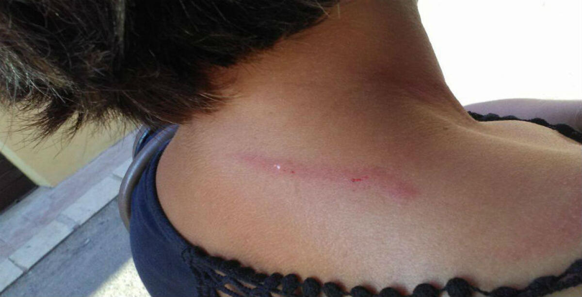 "Mi ha presa per il collo davanti a mio figlio", ferita una trentenne: la violenza a Villaggio Aldisio - Immagini di repertorio