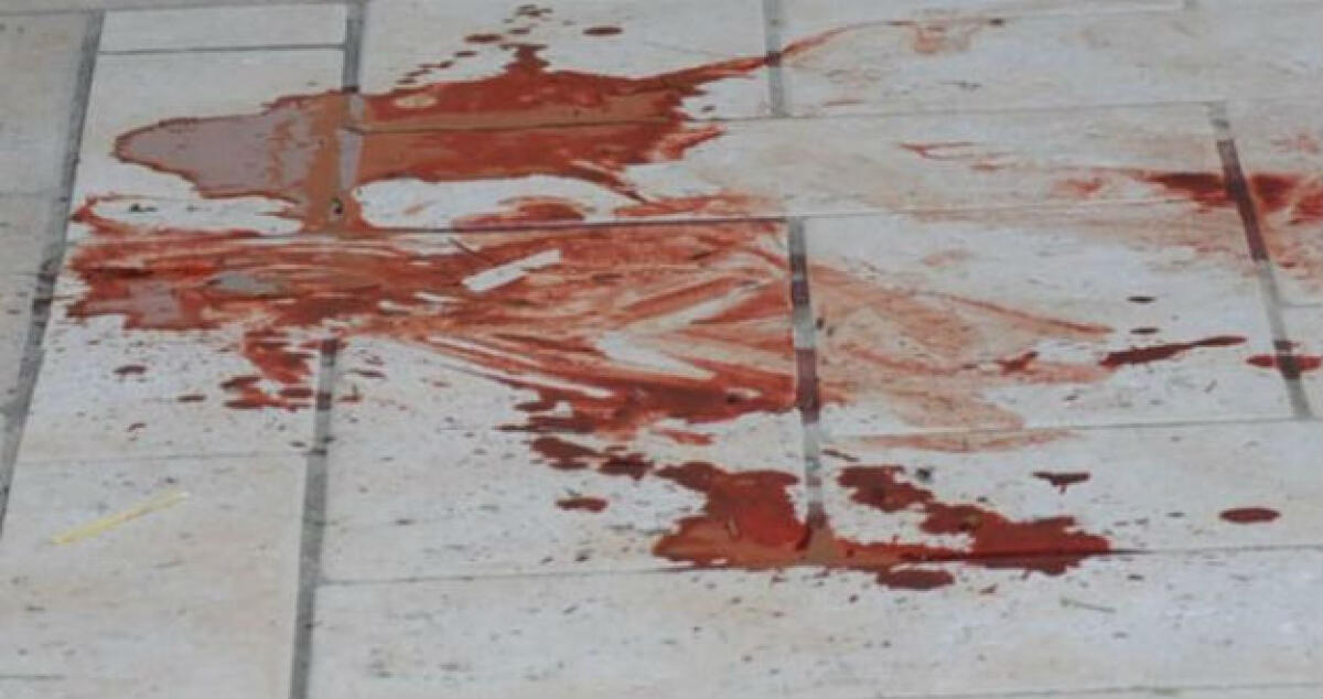 Ferì un compagno a scuola, era appena quindicenne: in Cassazione chiesta la conferma della condanna -