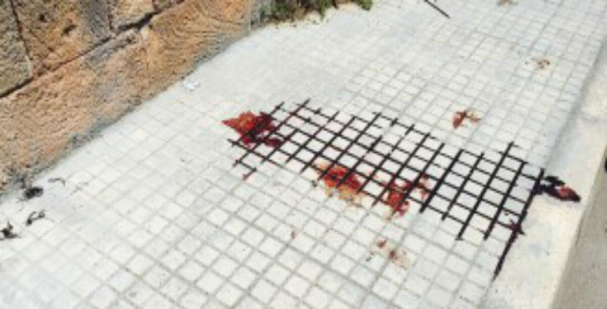 Tre feriti dopo una maxi rissa davanti al Tropicomed, spuntarono le lame: otto a processo - 