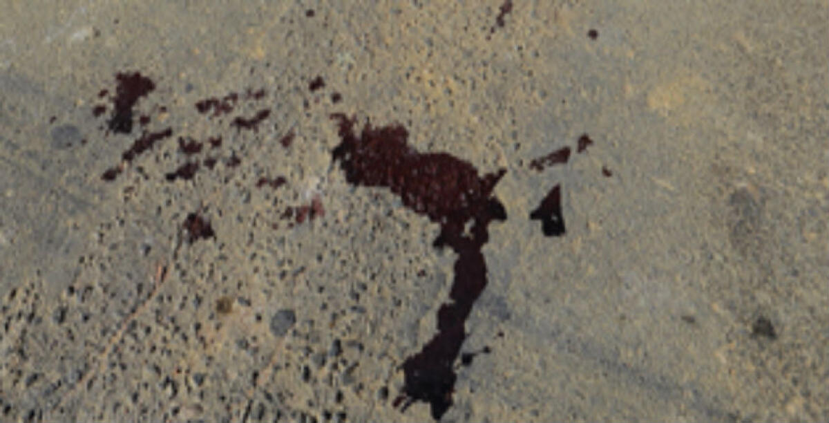 Ferito al volto dopo un'aggressione in centro storico, un uomo in ospedale -