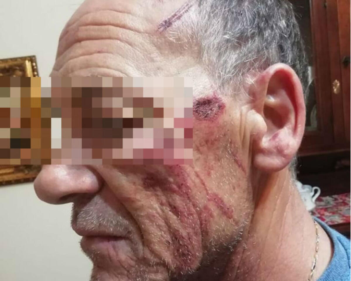 Ferito e finito in mare dopo un incidente in raffineria, operaio sospeso: "Assurdo...non ha colpa" - L'operaio ferito è stato sospeso