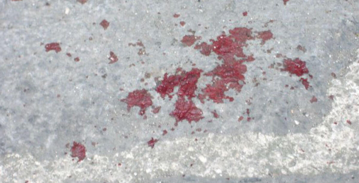 Pestato a sangue, vittima un giovane disabile mentale: "Voleva staccargli anche un lobo dell'orecchio" - 