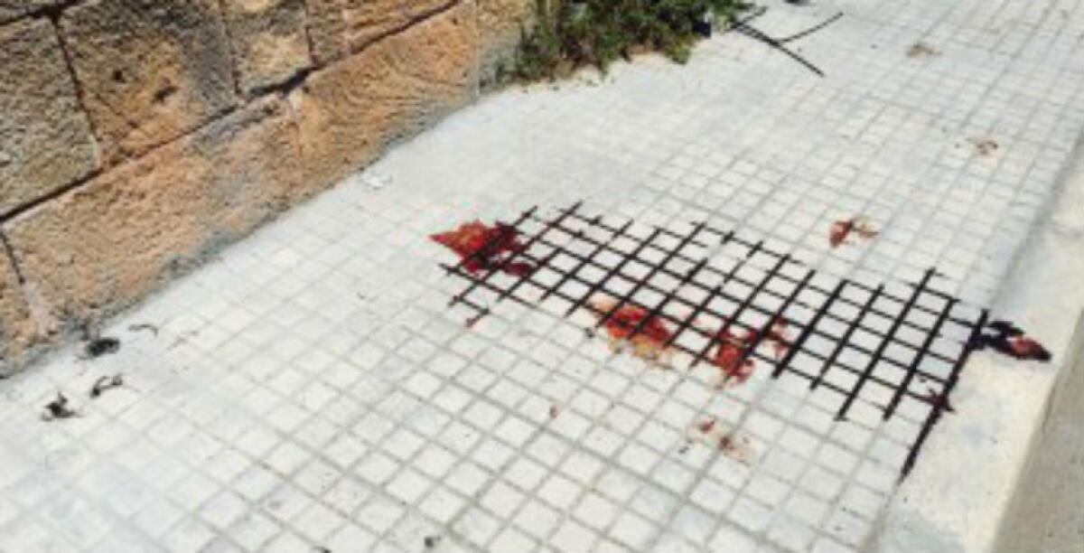 Non l'hanno ferito a bastonate, assolti madre e figlio: erano accusati di aver aggredito un anziano - 