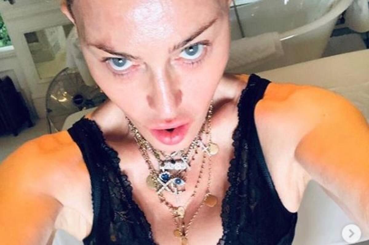 Madonna “Mi sottoporro’ a un intervento di medicina rigenerativa” - 