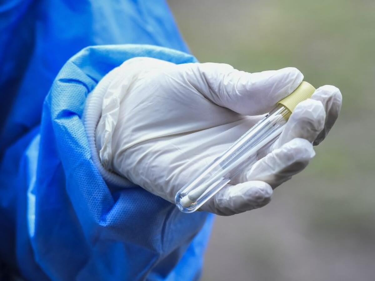 Coronavirus, da Granarolo 150.000 euro a Fondazione S.Orsola per ricerca - 