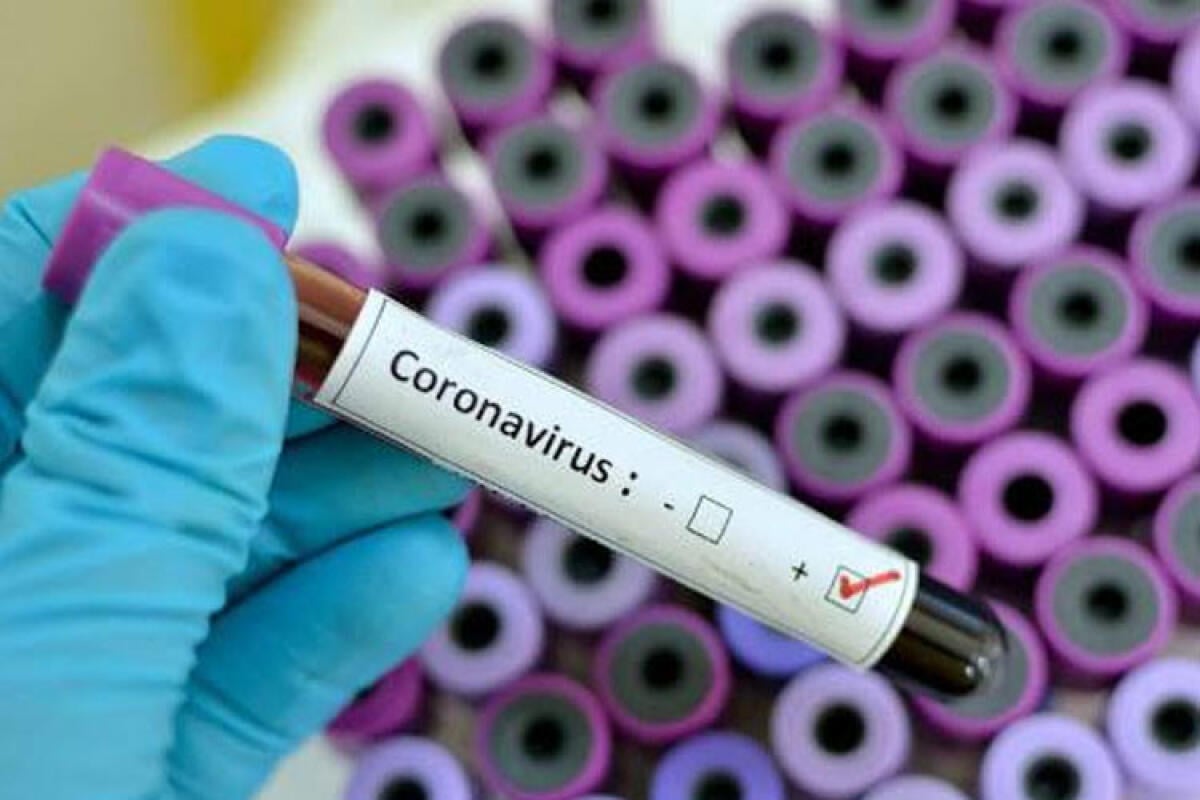 Allarme Covid, tamponi a tutti i dipendenti e ritorno al lavoro agile - 
