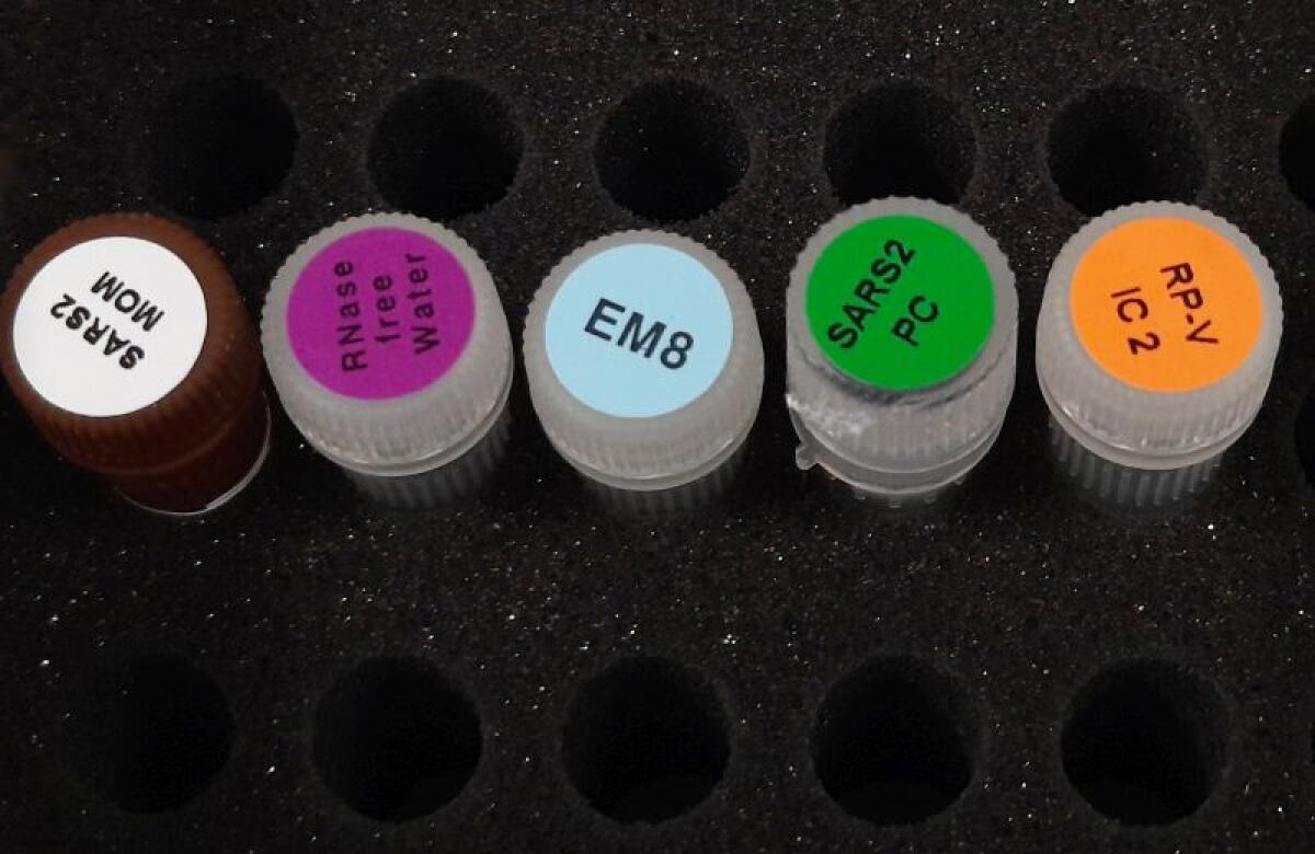 La Fondazione Kennedy dona migliaia di kit per tamponi al Bambino Gesù - 