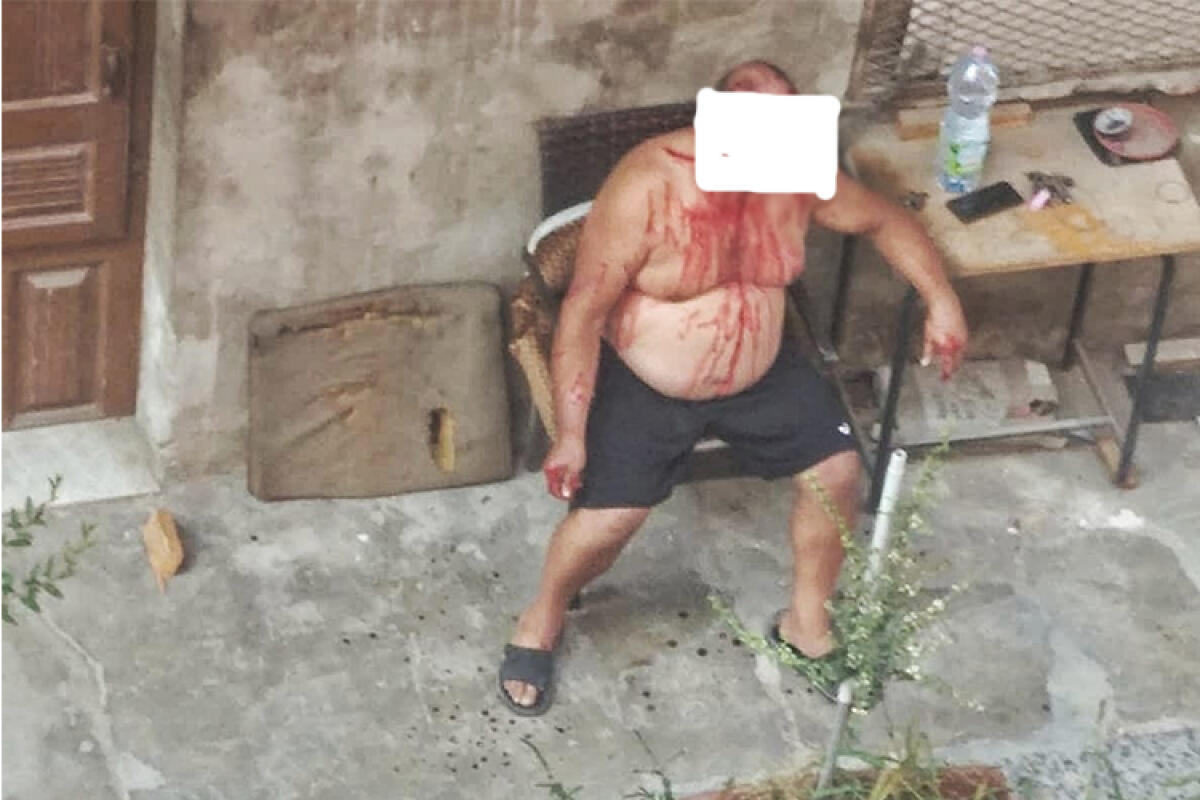 Lite in famiglia in via Ermocrate, intervengono polizia e carabinieri - 