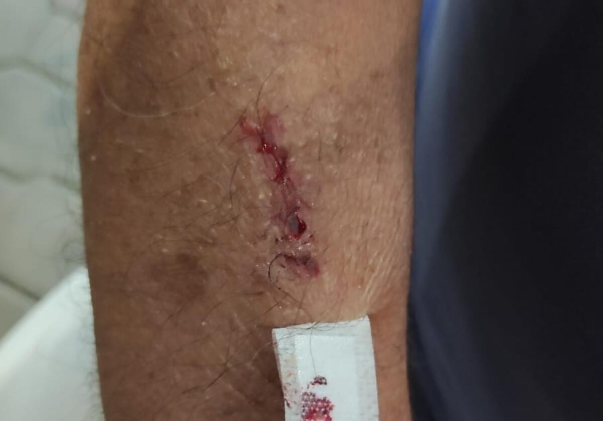 Fipe, "fioriere pericolose e centro storico tagliato fuori" - 