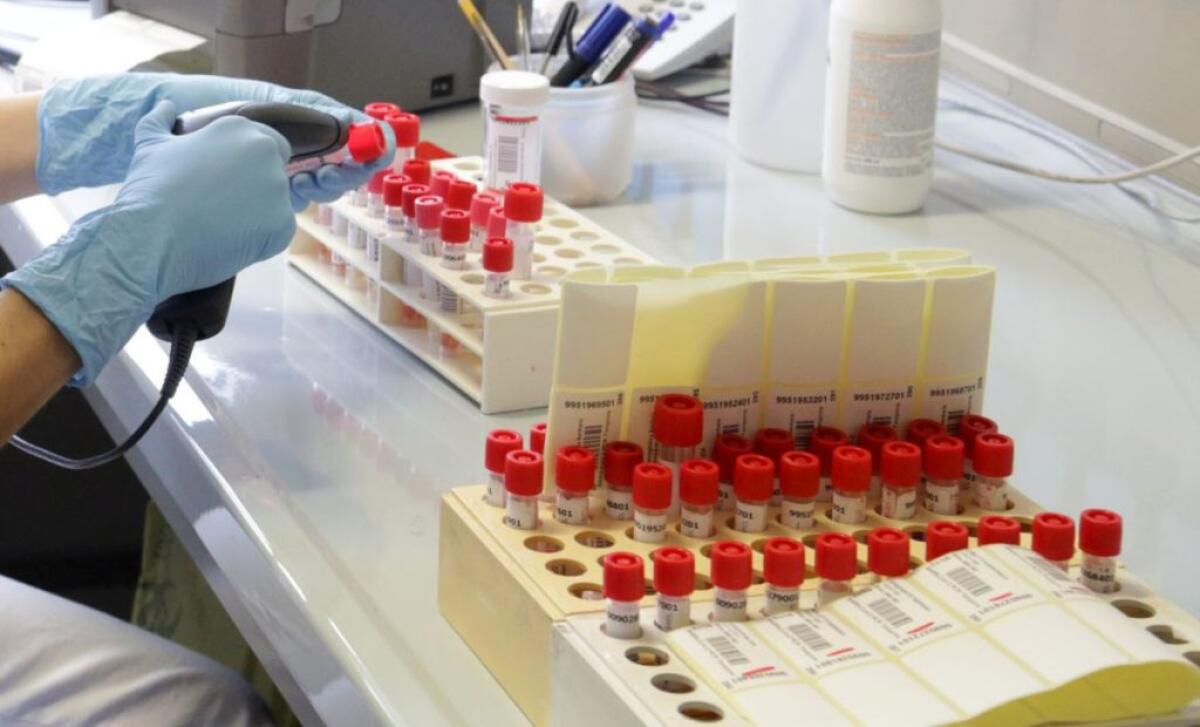 Malattie sessualmente trasmissibili +30% nella fase post Covid - 