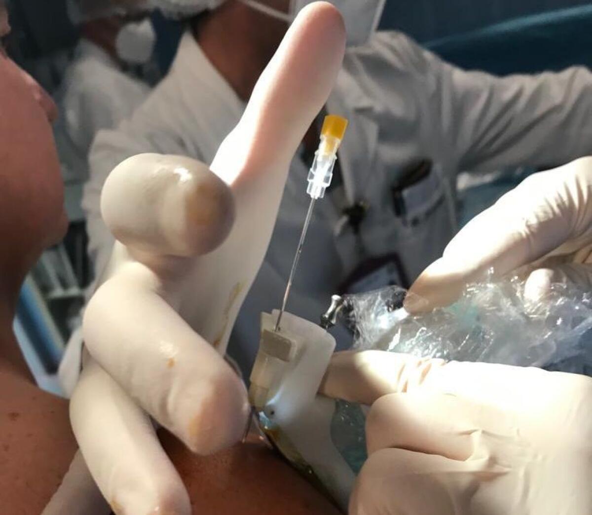 Policlinico di Palermo, cellule staminali per rigenerare tendini e articolazioni - 