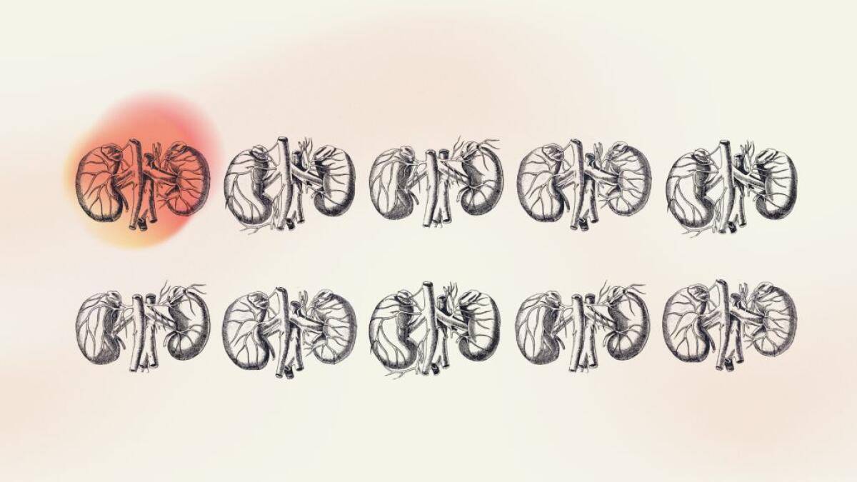 Malattia Renale Cronica, a lavoro su prevenzione e impatto economico - 