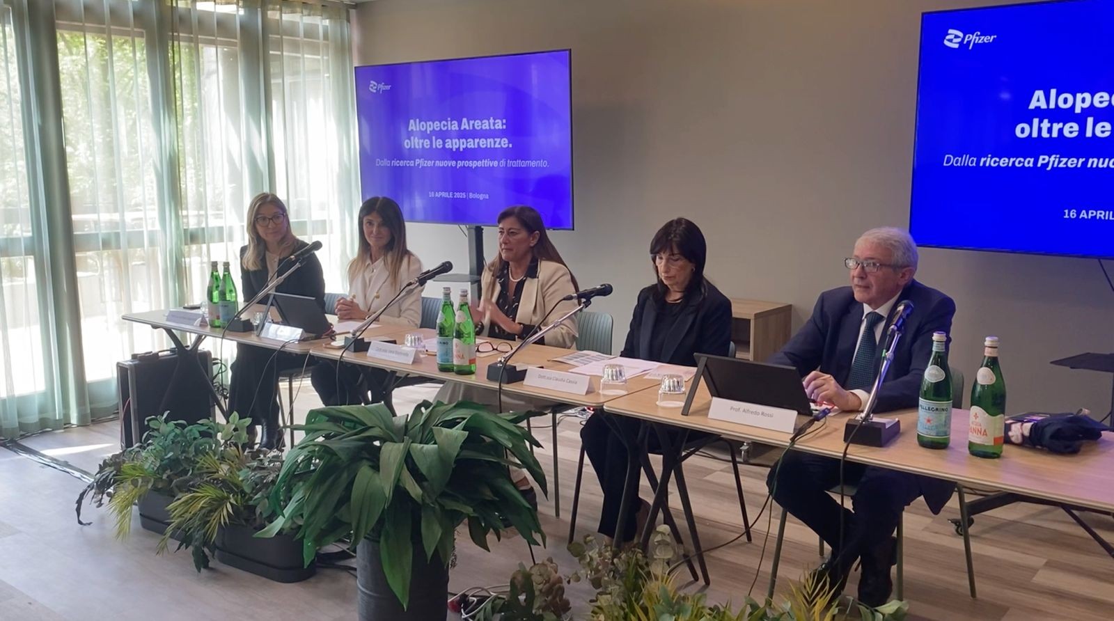 Alopecia Areata, da Pfizer nuove prospettive di trattamento -