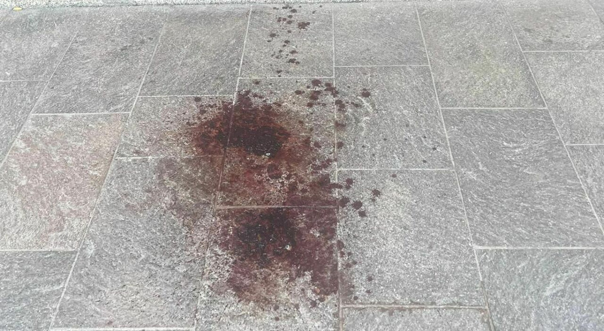 Quarantenne ferito da colpi di arma da fuoco, è in ospedale - 