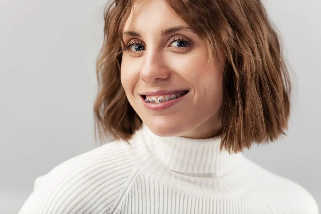 Italiani e sorriso, sempre più adulti con l’apparecchio ortodontico - 
