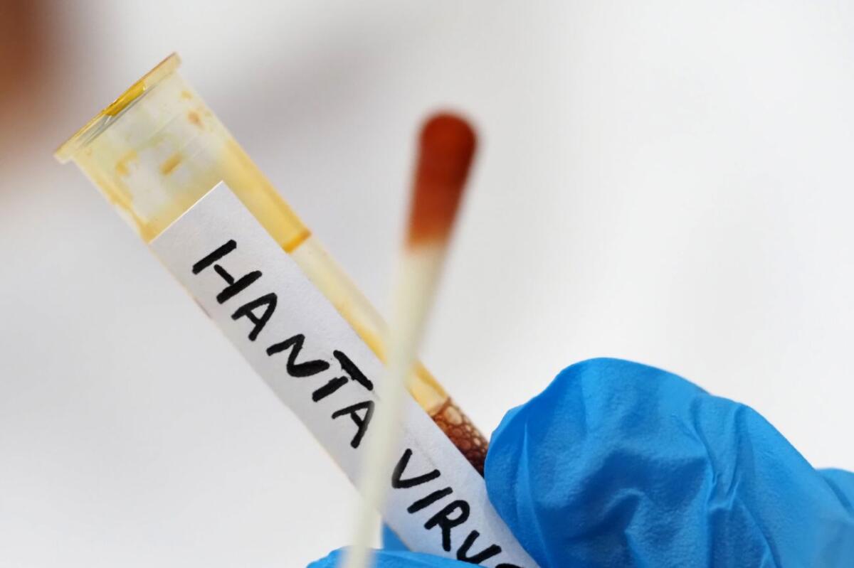 Hantavirus, negativa la paziente argentina ricoverata al Policlinico di Messina - 