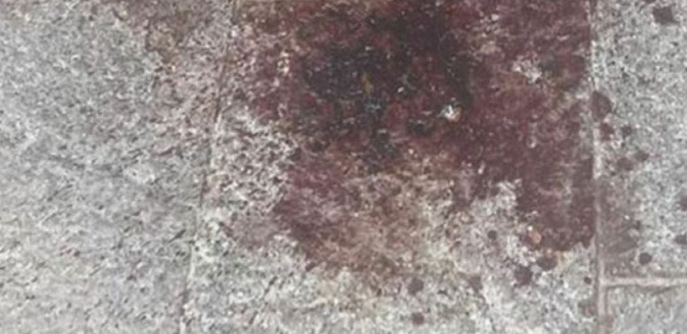 Quarantenne in ospedale con ferite da arma da taglio  - 