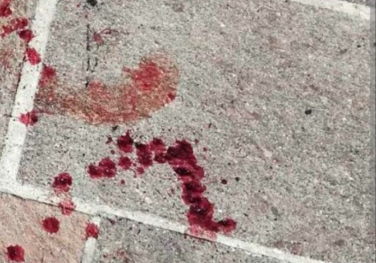 Ancora coltellate, sedicenne trasferito in ospedale: ferito durante una lite familiare  - 